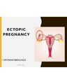 ECTOPIC PREGNANCY cover