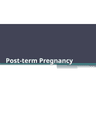 RISK FACTORS FOR FETAL DEATH cover