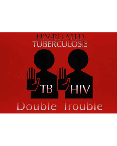 HIV AND TB INTERACTION cover