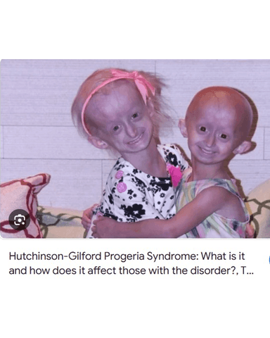 PREMATURE AGEING SYNDROME cover