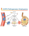 ASTHMA AND COPD cover
