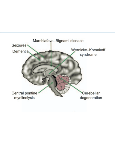 NEUROTOXICITY: TOXIC SUBSTANCES AND THEIR IMPACT ON THE BRAIN cover