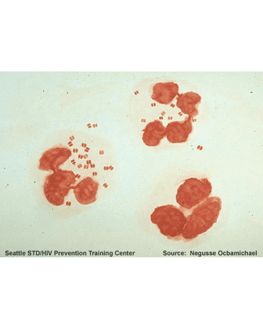 BACTERIAL STDs cover